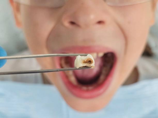 Best Weekend Emergency Dentist in Rose, LA